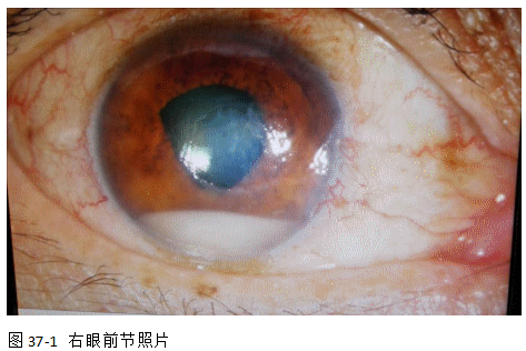 ZY016_194_2.gif